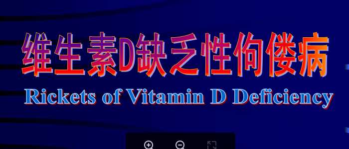 中山大学《儿科学》课件-5.佝偻病.pdf