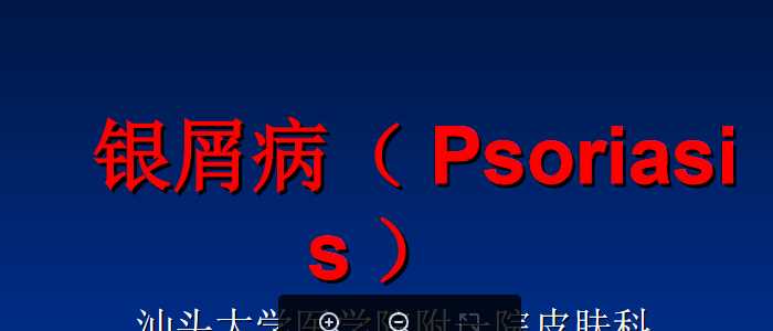 银屑病2.ppt