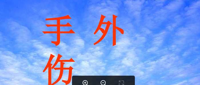 手外伤.ppt