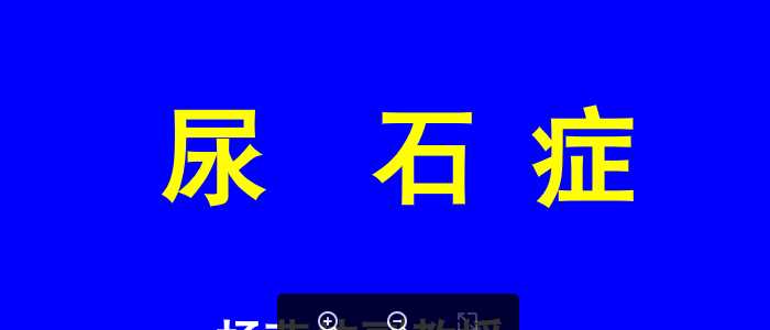 尿石症.ppt