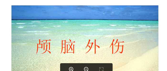 颅脑外伤CT表现.ppt